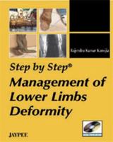 Management of Lower Limbs Deformity 8184486316 Book Cover
