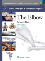 Master Techniques in Orthopaedic Surgery on CD-ROM: The Elbow (Master Techniques in Orthopaedic Surgery) 0781719917 Book Cover