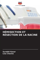 Hémisection Et Résection de la Racine (French Edition) 6207933443 Book Cover