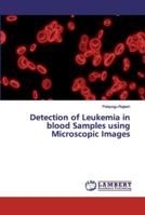 Detection of Leukemia in blood Samples using Microscopic Images 6200091625 Book Cover