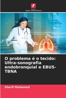 O problema é o tecido: Ultra-sonografia endobronquial e EBUS-TBNA 6205725711 Book Cover