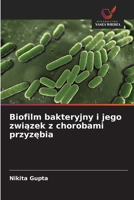 Biofilm bakteryjny i jego zwiazek z chorobami przyzebia (Polish Edition) 6209897142 Book Cover