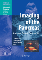 Imaging of the Pancreas: Acute and Chronic Pancreatitis 3642055494 Book Cover