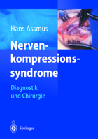 Nerven-Kompressions-Syndrome: Diagnostik Und Chirurgie 3642629032 Book Cover