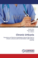 Chronic Urticaria: Prevalence of Positive Autologous Serum Skin Test in chronic urticaria and its correlation with Clinical severity 3659413585 Book Cover