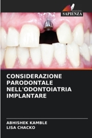 CONSIDERAZIONE PARODONTALE NELL'ODONTOIATRIA IMPLANTARE 6205888238 Book Cover