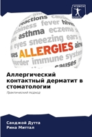 Аллергический контактн&# 6205833484 Book Cover