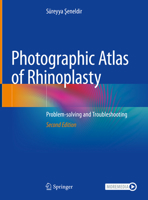 Photographic Atlas of Rhinoplasty: Problem-solving and Troubleshooting 3030443248 Book Cover