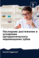 Последние достижения в ускорении ортодонтического перемещения зубов 6204067842 Book Cover