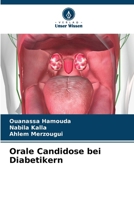 Orale Candidose bei Diabetikern (German Edition) 620850919X Book Cover