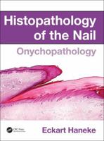 Histopathology of the Nail: Onychopathology 1482212323 Book Cover