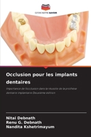 Occlusion pour les implants dentaires (French Edition) 6630068548 Book Cover