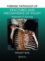 Forensic Pathology of Fractures and Mechanisms of Injury: Postmortem CT Scanning 1439881480 Book Cover