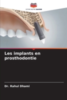 Les implants en prosthodontie (French Edition) 6207674766 Book Cover