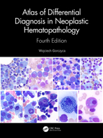 An Atlas of Differential Diagnosis in Neoplastic Hematopathology 0367637243 Book Cover