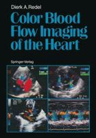 Color Blood Flow Imaging of the Heart 3540165215 Book Cover