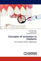 Concepts of occlusion in Implants: new concepts and their applications 3848486962 Book Cover