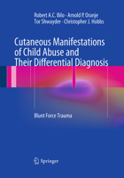 Cutaneous Manifestations of Child Abuse and Their Differential Diagnosis: Blunt Force Trauma 3642292860 Book Cover