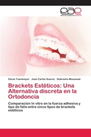 Brackets Estéticos: Una Alternativa discreta en la Ortodoncia 6202154918 Book Cover