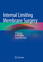 Internal Limiting Membrane Surgery 9811594023 Book Cover