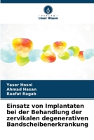Einsatz von Implantaten bei der Behandlung der zervikalen degenerativen Bandscheibenerkrankung (German Edition) 6209933009 Book Cover
