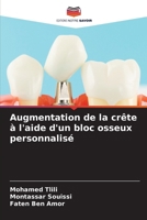 Augmentation de la crête à l'aide d'un bloc osseux personnalisé (French Edition) 6207162544 Book Cover