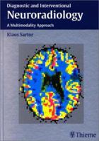 Diagnostic and Interventional Neuroradiology: A Multimodality Approach 1588901122 Book Cover