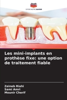 Les mini-implants en prothèse fixe: une option de traitement fiable (French Edition) 6208159261 Book Cover