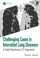 Challenging Cases in Interstitial Lung Diseases: A High-Resolution CT Approach 1032950048 Book Cover