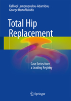 Total Hip Replacement: Case Series from a Leading Registry 3319851330 Book Cover