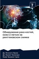 Обнаружение рака костей, кожи и легких на рентгеновском снимке 620283420X Book Cover