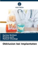 Okklusion bei Implantaten 620352347X Book Cover