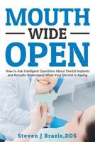 Mouth Wide Open: How To Ask Intelligent Questions About Dental Implants and Actually Understand What Your Dentist Is Saying 0692728406 Book Cover