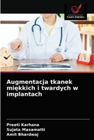 Augmentacja tkanek miękkich i twardych w implantach 6203232114 Book Cover