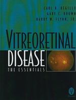 Vitreoretinal Disease: The Essentials 0865777616 Book Cover