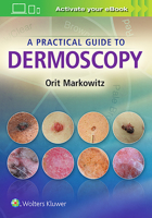A Practical Guide to Dermoscopy 1451192630 Book Cover