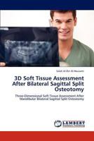 3D Soft Tissue Assessment After Bilateral Sagittal Split Osteotomy: Three-Dimensional Soft Tissue Assessment After Mandibular Bilateral Sagittal Split Osteotomy 3659295418 Book Cover