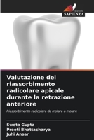 Valutazione del riassorbimento radicolare apicale durante la retrazione anteriore (Italian Edition) 6134976571 Book Cover