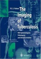 The Imaging of Tuberculosis: With Epidemiological, Pathological and Clinical Correlation 3540418210 Book Cover