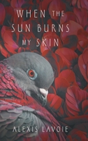 When the Sun Burns My Skin (Healing from the Burns) 1038334330 Book Cover
