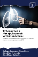 Туберкулез с лекарственной устойчивостью:: сложная проблема здравоохранения в странах с ограниченными ресурсами (ДРК) 6205925915 Book Cover