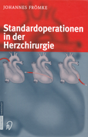 Standardoperationen in Der Herzchirurgie 3798514259 Book Cover