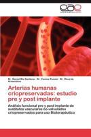 Arterias Humanas Criopreservadas: Estudio Pre y Post Implante 3845481269 Book Cover