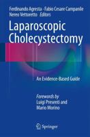 Laparoscopic Cholecystectomy: An Evidence-Based Guide 3319054066 Book Cover