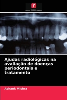 Ajudas radiológicas na avaliação de doenças periodontais e tratamento 6204072269 Book Cover