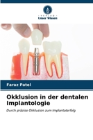 Okklusion in der dentalen Implantologie (German Edition) 6206582515 Book Cover