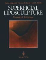 Superficial Liposculpture: Manual of Technique 0387979174 Book Cover