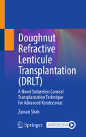 Doughnut Refractive Lenticule Transplantation (DRLT): A Novel Sutureless Corneal Transplantation Technique for Advanced Keratoconus 9819240697 Book Cover