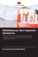 Défaillances des implants dentaires 6202366648 Book Cover