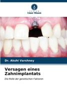 Versagen eines Zahnimplantats (German Edition) 6207139585 Book Cover